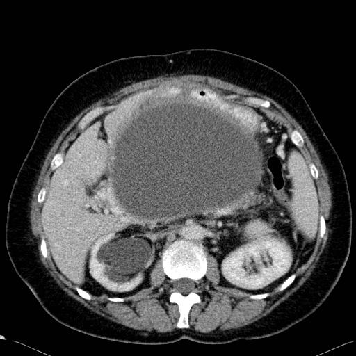 Gastroenterology question 5 image