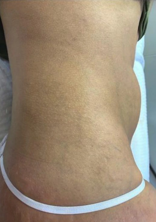 After image