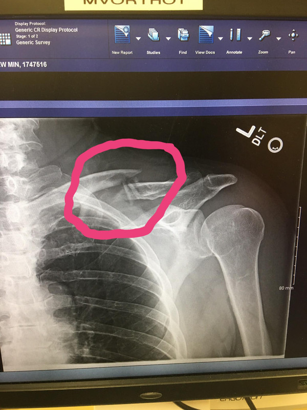 BA46A196-9472-4735-8CB7-1FF84D28D8CC