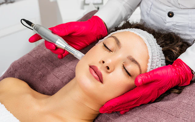 Microneedling