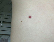 7D1474D3-2063-4B28-97E7-19A9A72DEA4D