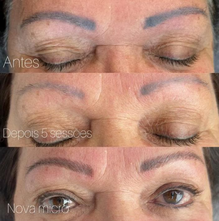 Trabalho de micropigmentação