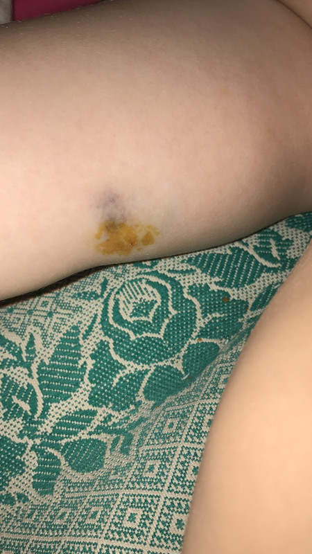 A5E0A312-4EF4-4545-97F8-B3CDEA4F52DF