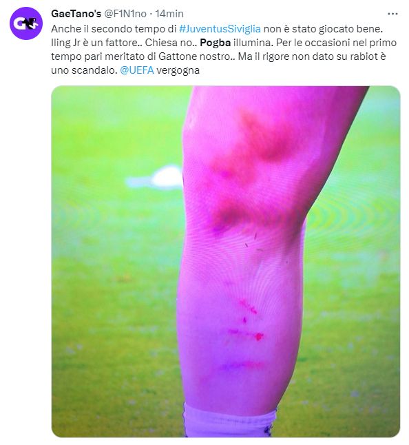 gamba di rabiot dopo fallo in area