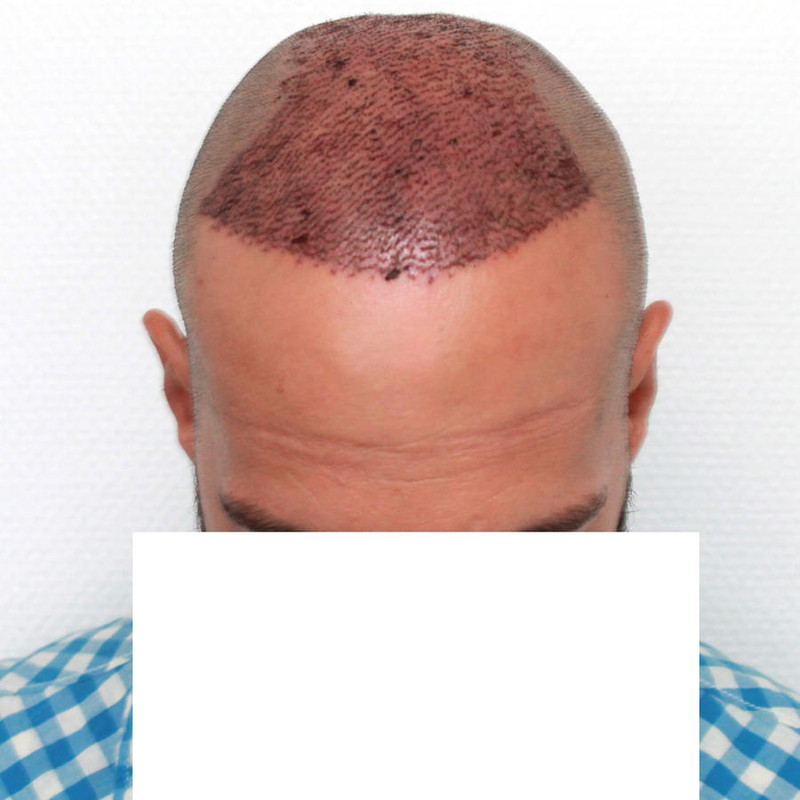image_2089 - copia
