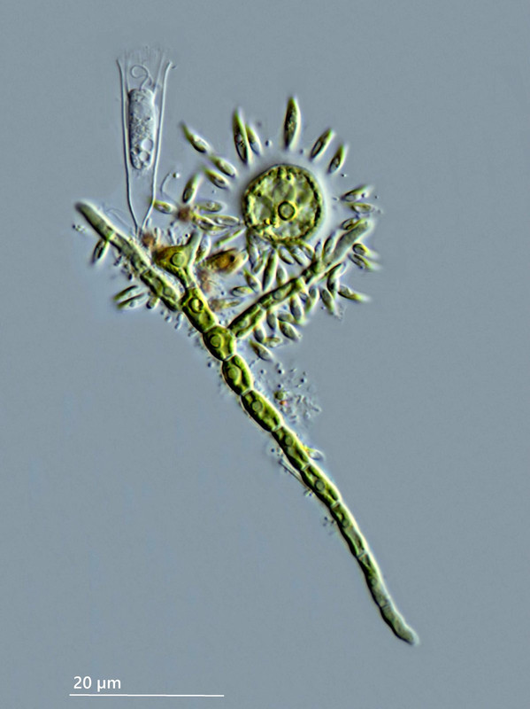 Salpingoeca 01 vaginicola Gehäuse-Flag mit (ev) Stigeoclonium und Characium DIK 100 Komp