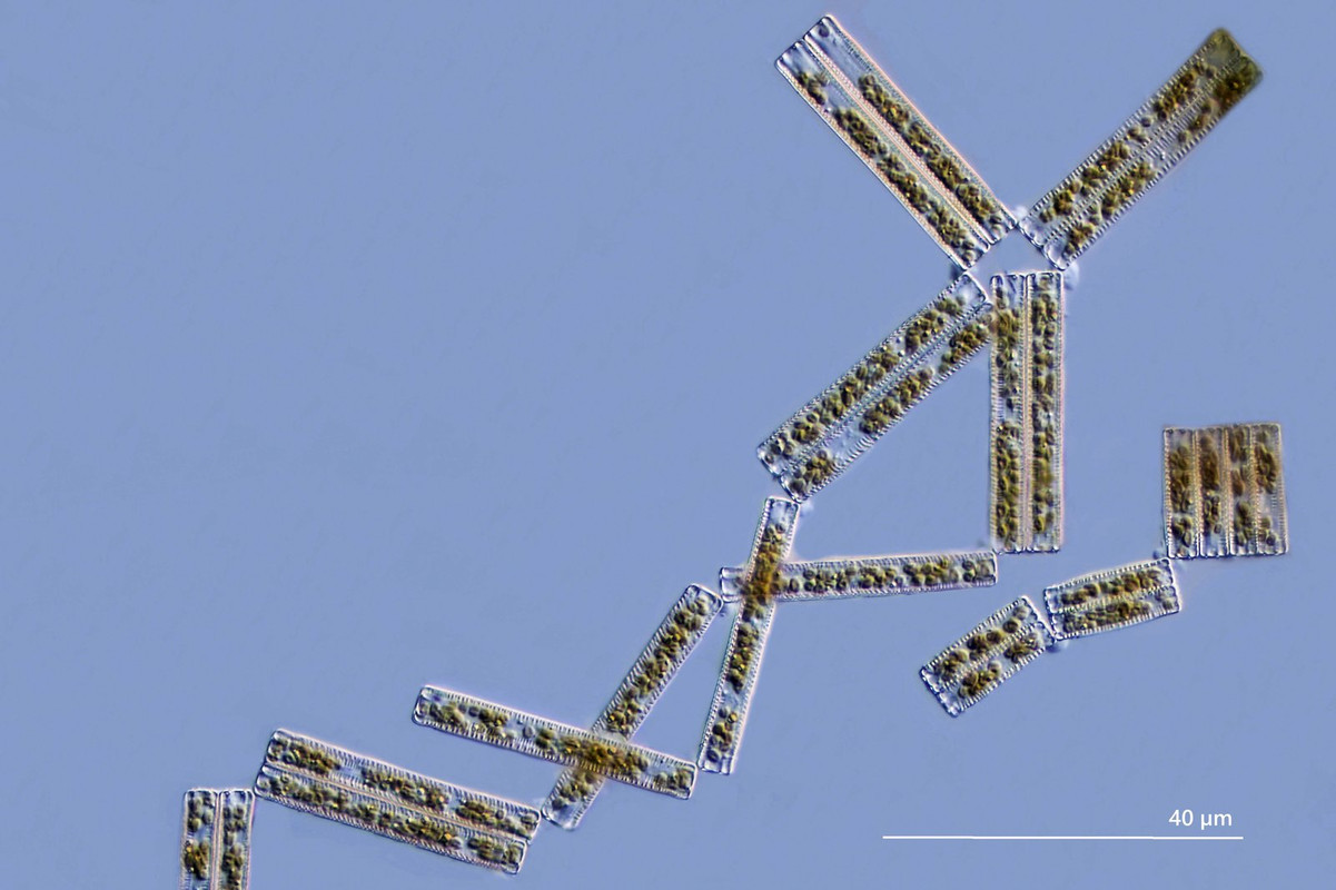 Diatoma 10 tenuis (elongata) Gestreckte Zickzack-Alge Kette  GA DIK 100 Stack 8