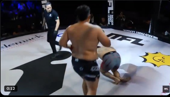 ММА боец с брутално счупване на крака