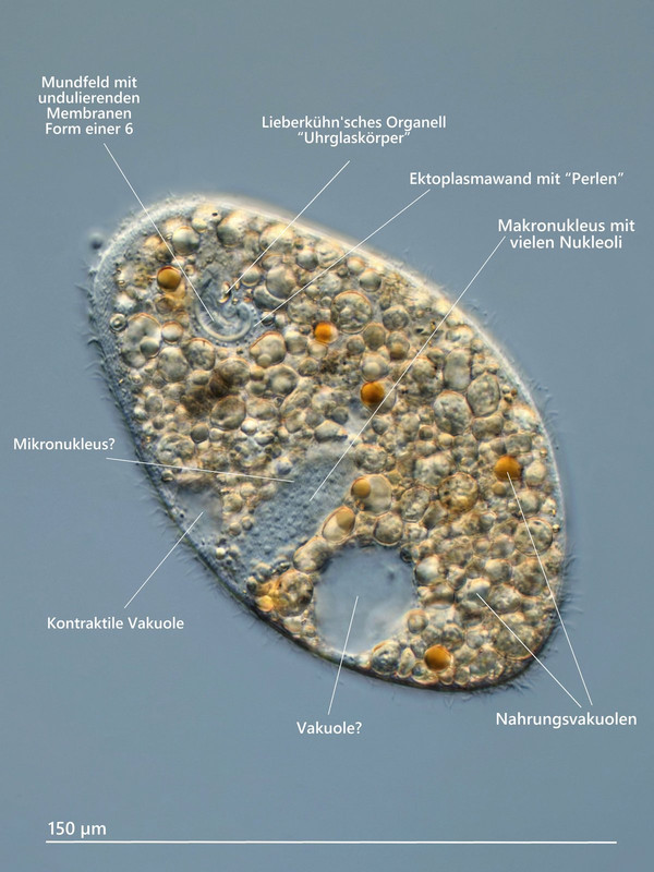 Ophryoglena 02 (ev) atra Osterei-Ciliat Beschriftung DIK 100