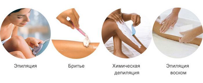 Какой лучший метод удаления волос в домашних условиях? дело только Какой лучший метод удаления волос в домашних условиях? дело только