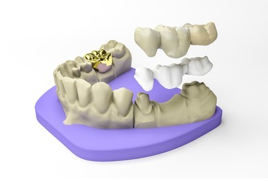 Restauração pronta