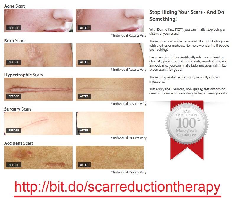 Reduce-erase-scars-without-drugs-or-operation.jpg