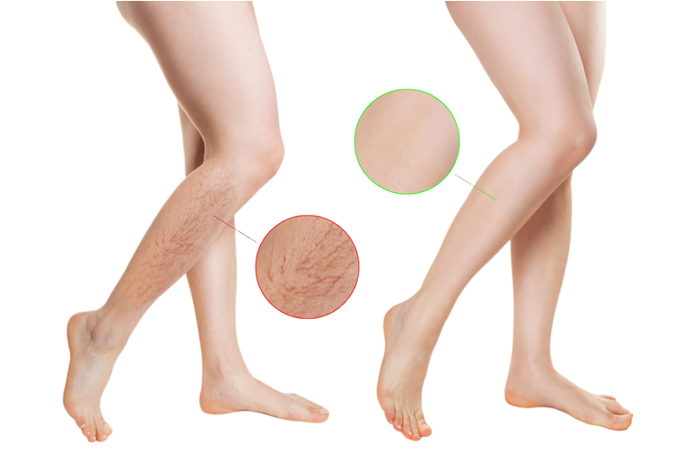 Секреты здоровых ног. Пакет «Минимум»  (Александра Бонина)