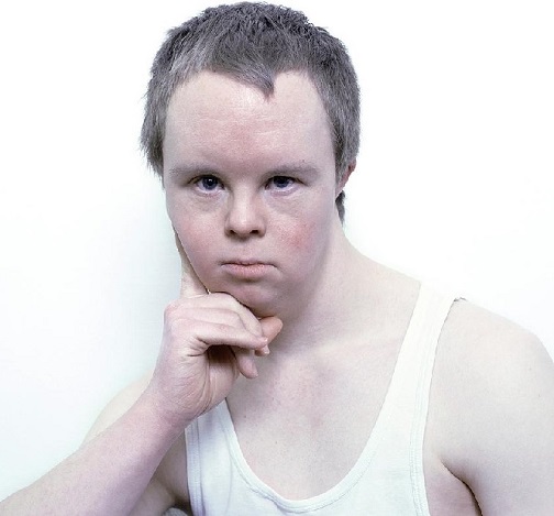 face-of-a-man-with-downs-syndrome-larry-
