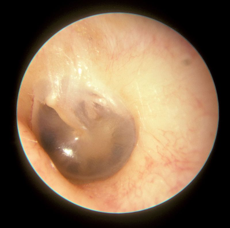 Otolaryngology question 2 image
