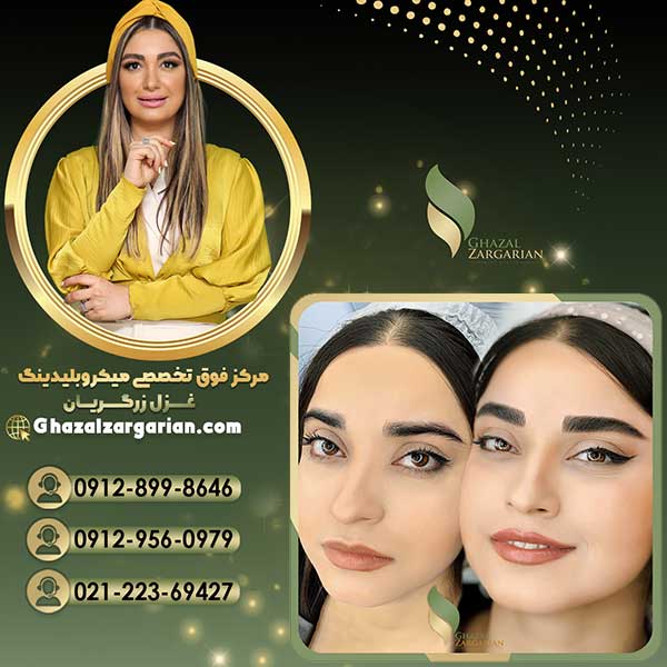 عکس میکرو ابرو قبل و بعد (Microblading eyebrows before and after photos) 