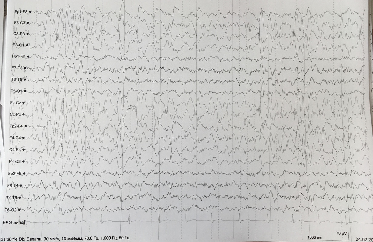 1D65053B-033B-4C57-9FBC-10E75F30059D