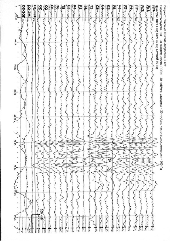 963873294b80479d965a30243f1151787COgqKfaoS7IG2sk-2