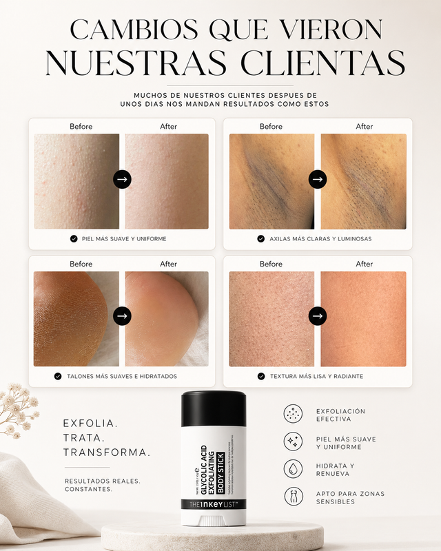 Imagen personalizada