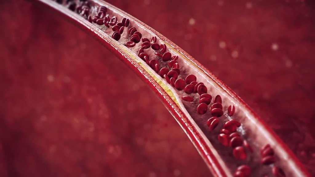 [Image: m5os8dzj06cz.jpg]