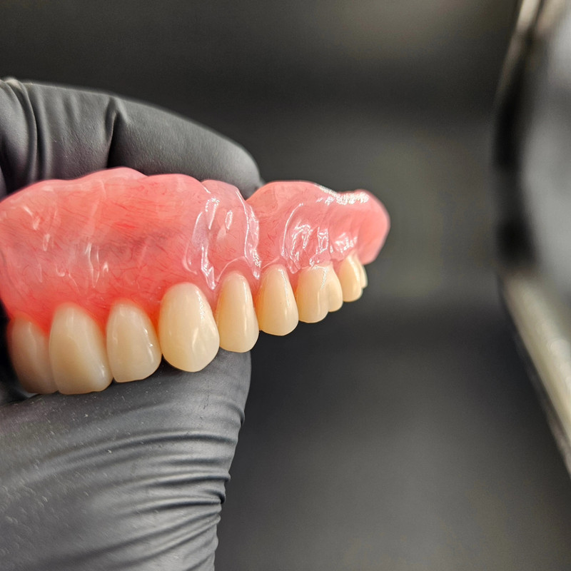 Proteza totala cu textura gingivala naturala si venaturi