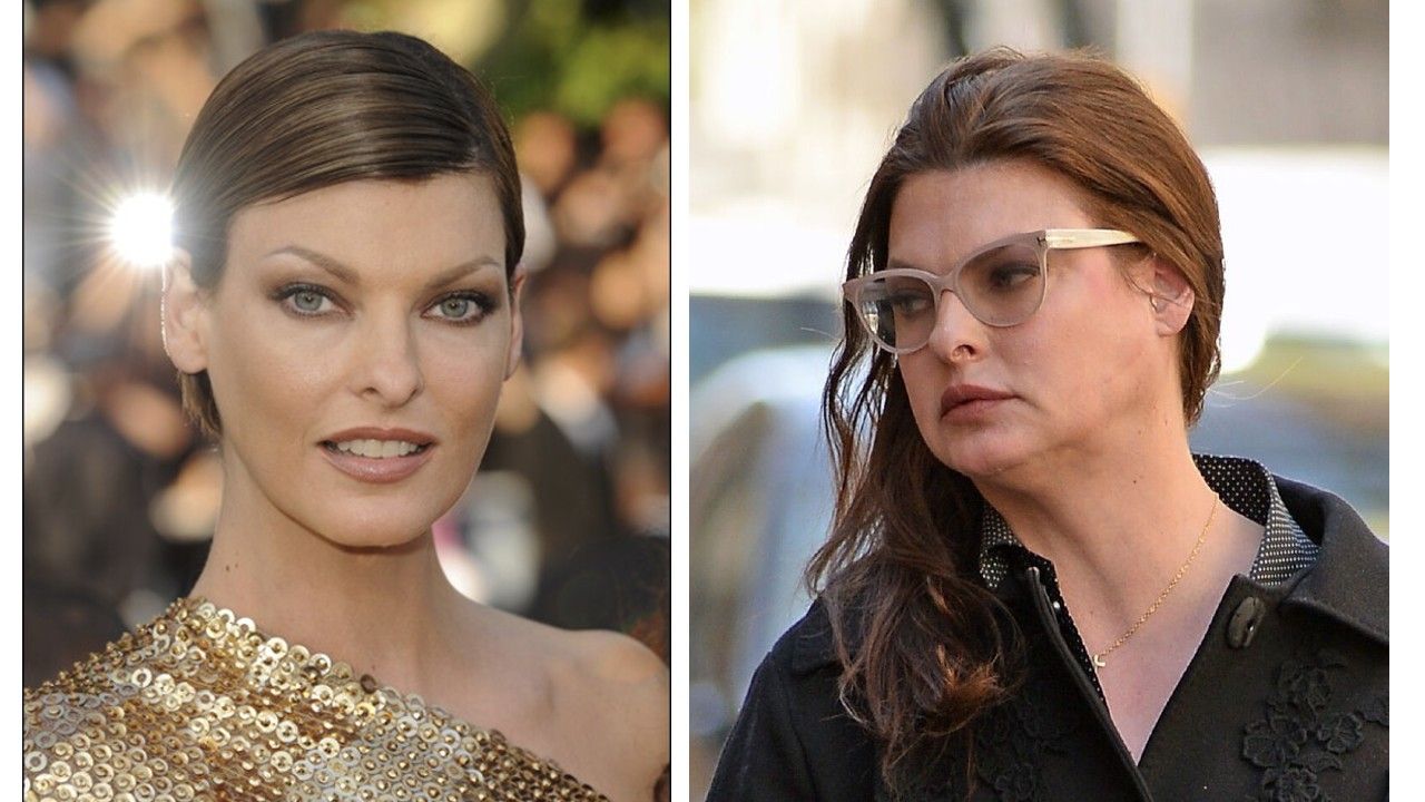 FOTO Linda Evangelista parla sul trattamento estetico che l'ha "deformata".