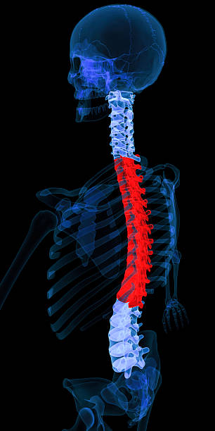 cauda equina syndrome