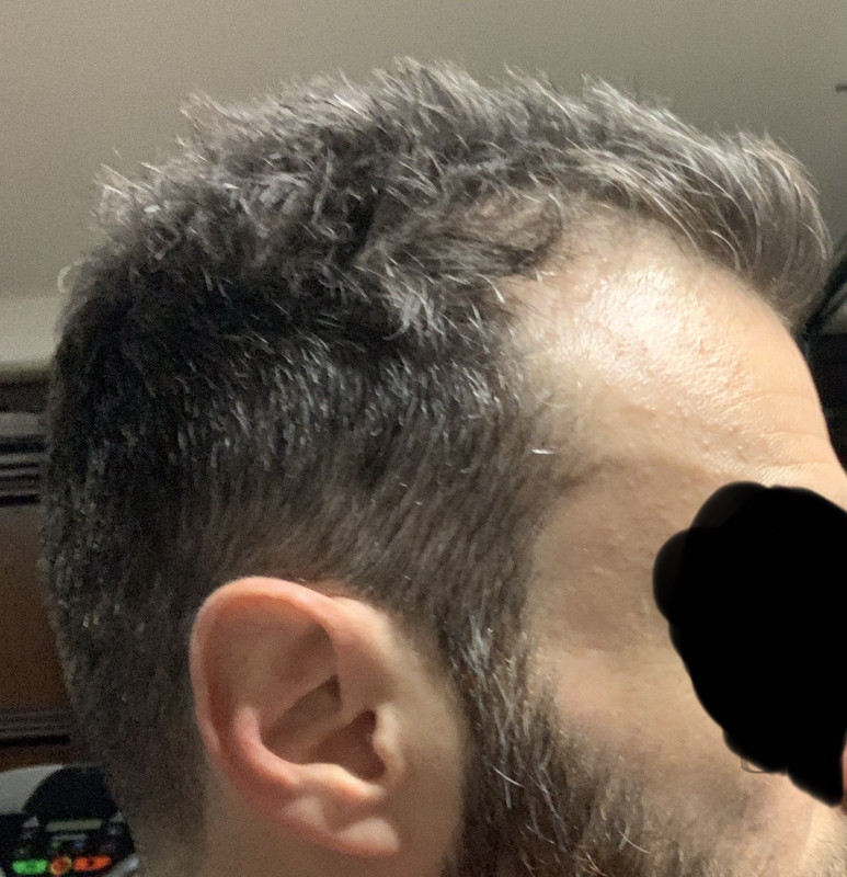 A326C5B8-60AD-4841-9F54-4FB464064AF3_1_201_a