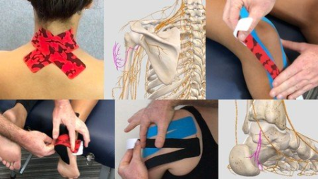 Kinesiology Taping - A Cutaneous Nervous System Approach