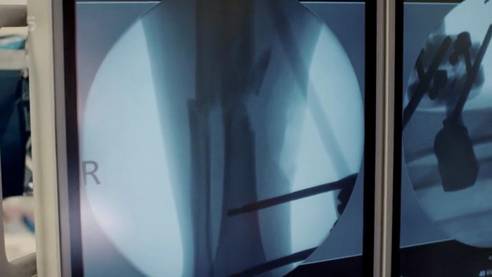 [Image: y6y6xru26kli.png]