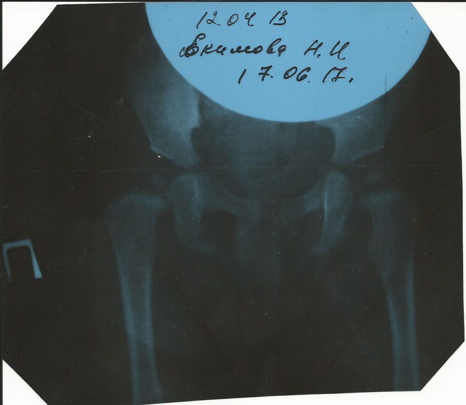 рентген_Нади