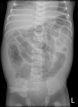 Pulmonology question 8 image