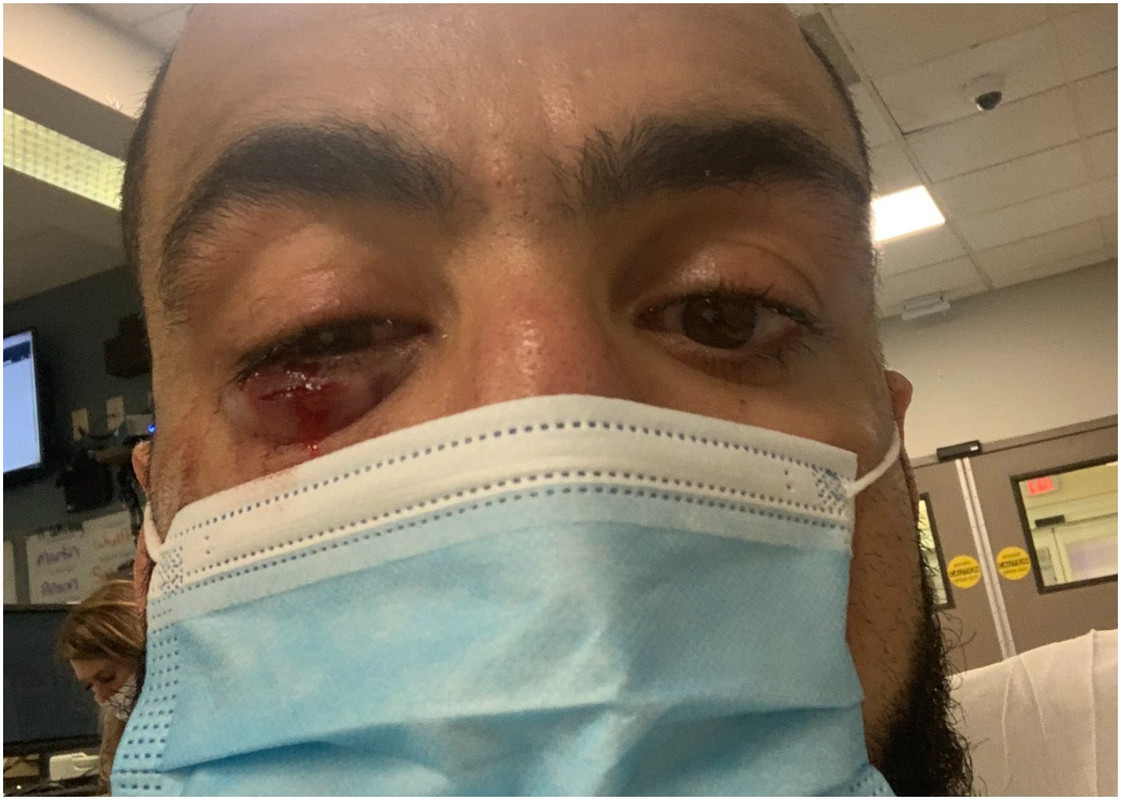 Белал Мохамед е добре и призова за реванш с Едуардс