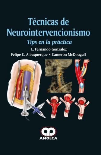 Portada de Técnicas de Neurointervencionismo: Tips en la práctica
