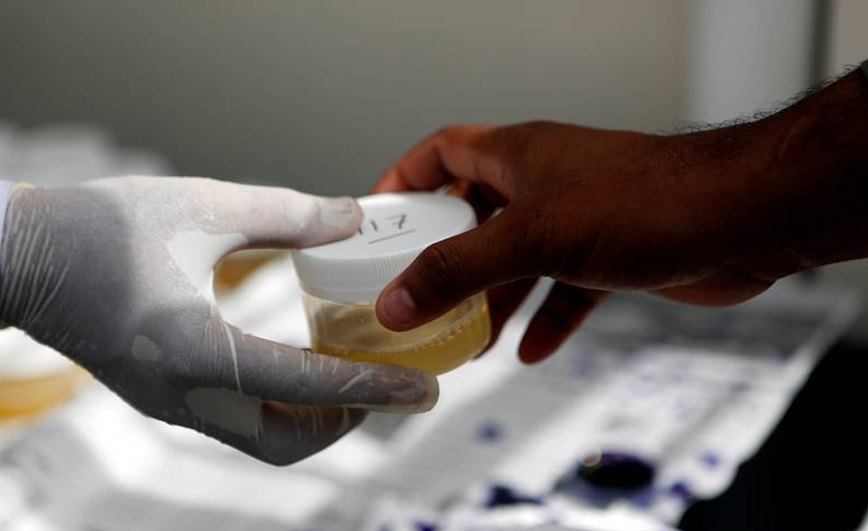 Crean prueba de orina para detectar anticuerpos contra el COVID