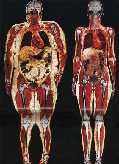 body-scans