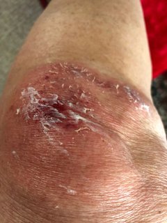 leg.jpg
