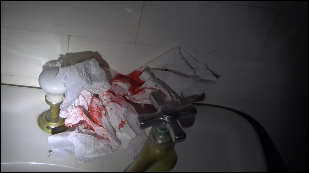 [Image: 4fdyx79xc0ld.png]