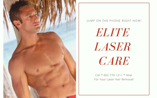 laser hair removal