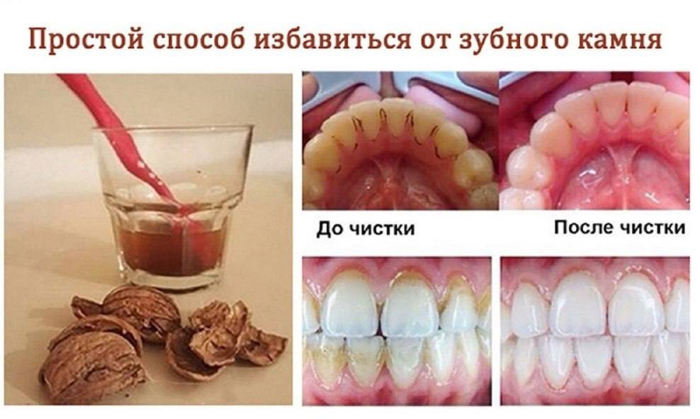 [Изображение: photo-2025-11-22-04-33-08.jpg]