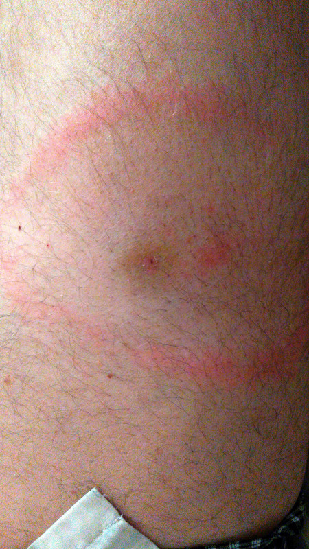 15й день 22.07.2023