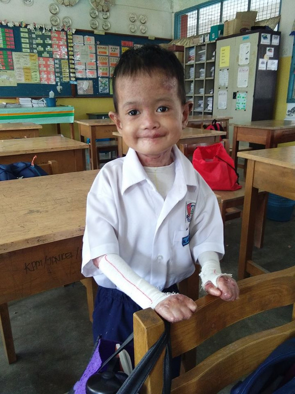 Tulisan Surah Al-Fatihah Adik Ini Buat Si Ibu Sebak, Meskipun Hidap Penyakit Kulit Serius. 7