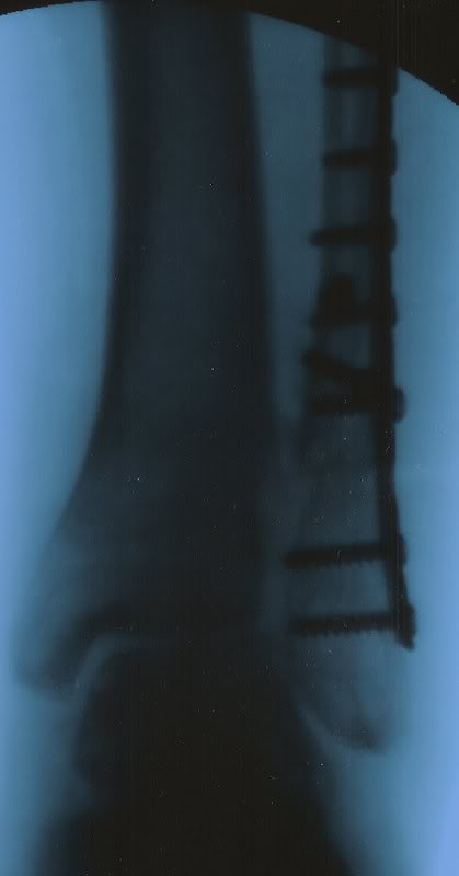 Scan0001