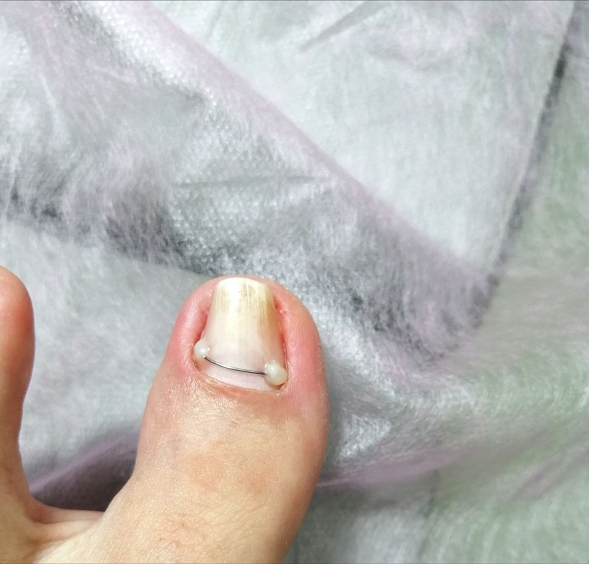 3872B38A-870E-439A-93E0-DF8E10EAAC0E