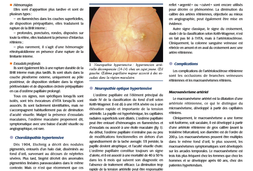 pathologie vasculaire retinienne