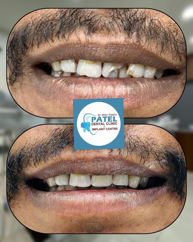 Patel Dental Clinic - Clean treatment environment