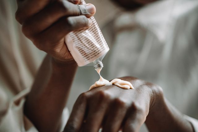 a woman with dry, rough and cracky skin applying heavy moisturizer to prevent her skin skin from seasonal dryness 