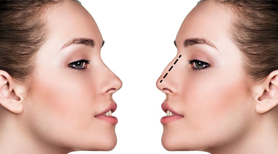 Millennials ¿Cuál es la cirugía estética que más desean?