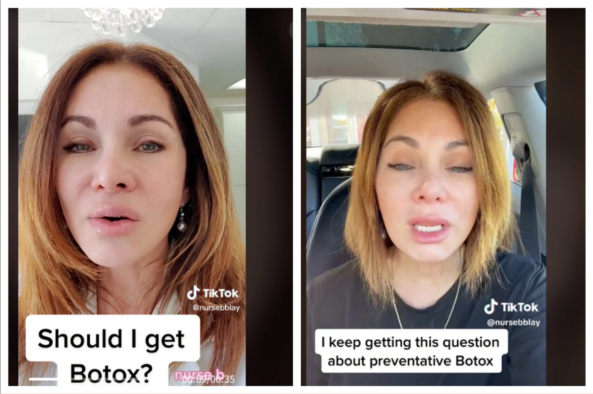 Mujer dejó de usar botox tras 20 años; así luce su rostro