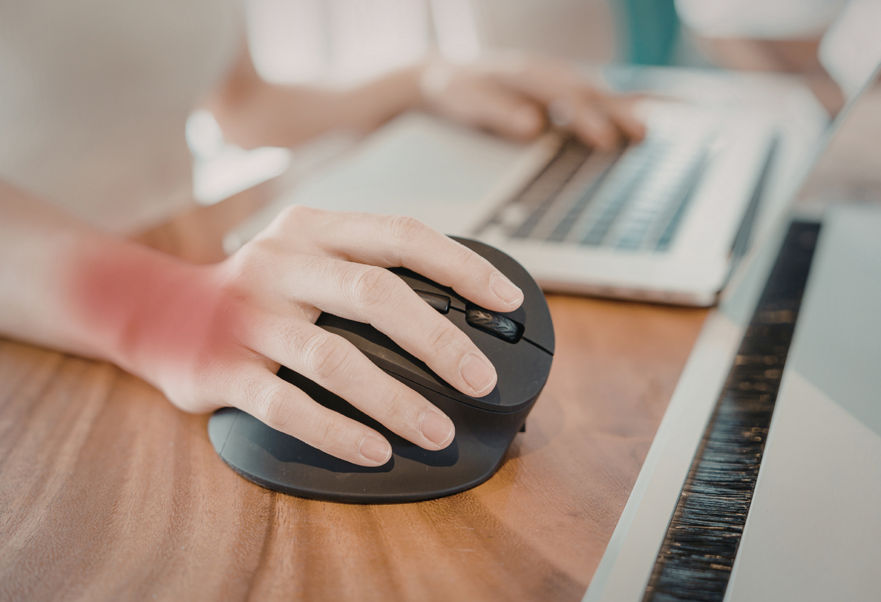 Síndrome del túnel carpiano